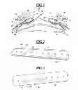 Fig. 02 - METHOD AND APPARATUS FOR SURGICALLY CLOSING AN OPEN ABDOMEN