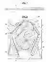 Fig. 04 - METHOD AND APPARATUS FOR SURGICALLY CLOSING AN OPEN ABDOMEN
