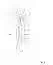 Fig. 02 - Twist-grip anchors and methods of use