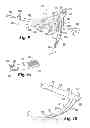 Fig. 07 - Instruments and methods for stabilization of bony structures