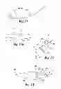 Fig. 08 - Instruments and methods for stabilization of bony structures