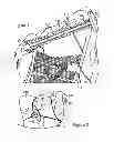 Fig. 02 - ATRAUMATIC FASTENER AND BONE STABILIZATION SYSTEM AND METHOD OF USE