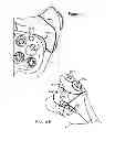 Fig. 04 - ATRAUMATIC FASTENER AND BONE STABILIZATION SYSTEM AND METHOD OF USE