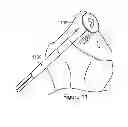 Fig. 08 - ATRAUMATIC FASTENER AND BONE STABILIZATION SYSTEM AND METHOD OF USE