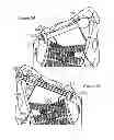 Fig. 16 - ATRAUMATIC FASTENER AND BONE STABILIZATION SYSTEM AND METHOD OF USE