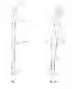 Fig. 02 - ADJUSTABLE DEVICES FOR TREATING ARTHRITIS OF THE KNEE