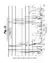 Fig. 33 - Method and apparatus for implantable cardiac lead integrity analysis