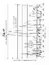 Fig. 43 - Method and apparatus for implantable cardiac lead integrity analysis