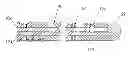 Fig. 01 - Optical fiber-fine wire lead for electrostimulation and sensing