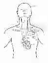 Fig. 01 - Implantable neurostimulator-implemented method for managing bradycardia through vagus nerve stimulation