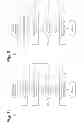 Fig. 05 - Implantable neurostimulator-implemented method for managing bradycardia through vagus nerve stimulation
