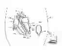 Fig. 01 - LEADLESS CARDIAC STIMULATION SYSTEMS