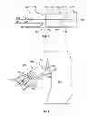 Fig. 08 - LEADLESS CARDIAC STIMULATION SYSTEMS