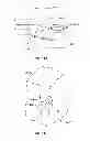 Fig. 14 - LEADLESS CARDIAC STIMULATION SYSTEMS