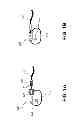 Fig. 02 - Implantable electrostimulation assembly and adapter and electrode lead of the same