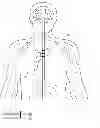 Fig. 01 - System, apparatus and method for interacting with a targeted tissue of a patient