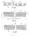 Fig. 07 - Electrical stimulation paddle leads and methods of making and using