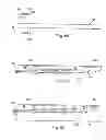 Fig. 09 - Electrical stimulation paddle leads and methods of making and using