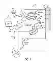 Fig. 02 - Implantable medical device having electromagnetic interference filter device to reduce pocket tissue heating