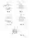 Fig. 07 - TISSUE-CAPTURED ANCHORS AND METHODS OF USE