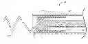 Fig. 01 - Active fixation lead having a rotatable curve
