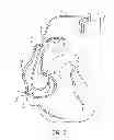 Fig. 02 - Active fixation lead having a rotatable curve