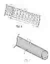 Fig. 06 - Active fixation lead having a rotatable curve