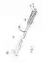 Fig. 02 - Preferentially electropolished stent system and method of manufacture