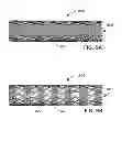 Fig. 09 - Preferentially electropolished stent system and method of manufacture