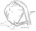 Fig. 01 - METHOD AND APPARATUS FOR EFFECTING AN AORTIC VALVE BYPASS, INCLUDING THE PROVISION AND USE OF A T-STENT FOR EFFECTING A DISTAL ANASTOMOSIS FOR THE SAME