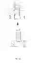 Fig. 05 - METHOD AND APPARATUS FOR EFFECTING AN AORTIC VALVE BYPASS, INCLUDING THE PROVISION AND USE OF A T-STENT FOR EFFECTING A DISTAL ANASTOMOSIS FOR THE SAME
