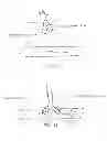 Fig. 10 - METHOD AND APPARATUS FOR EFFECTING AN AORTIC VALVE BYPASS, INCLUDING THE PROVISION AND USE OF A T-STENT FOR EFFECTING A DISTAL ANASTOMOSIS FOR THE SAME