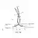 Fig. 12 - METHOD AND APPARATUS FOR EFFECTING AN AORTIC VALVE BYPASS, INCLUDING THE PROVISION AND USE OF A T-STENT FOR EFFECTING A DISTAL ANASTOMOSIS FOR THE SAME