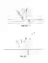 Fig. 20 - METHOD AND APPARATUS FOR EFFECTING AN AORTIC VALVE BYPASS, INCLUDING THE PROVISION AND USE OF A T-STENT FOR EFFECTING A DISTAL ANASTOMOSIS FOR THE SAME
