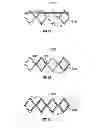Fig. 03 - Devices and methods for treatment of abdominal aortic aneurysm