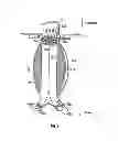 Fig. 04 - Devices and methods for treatment of abdominal aortic aneurysm