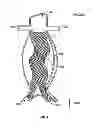 Fig. 05 - Devices and methods for treatment of abdominal aortic aneurysm