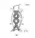Fig. 07 - Devices and methods for treatment of abdominal aortic aneurysm