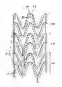 Fig. 01 - Laser system and processing conditions for manufacturing bioabsorbable stents