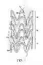 Fig. 02 - Laser system and processing conditions for manufacturing bioabsorbable stents