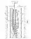 Fig. 05 - TRANSLUMINAL CARDIAC BALL VALVE AND METHOD FOR DEPLOYMENT THEREOF