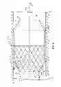 Fig. 06 - TRANSLUMINAL CARDIAC BALL VALVE AND METHOD FOR DEPLOYMENT THEREOF