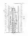 Fig. 10 - TRANSLUMINAL CARDIAC BALL VALVE AND METHOD FOR DEPLOYMENT THEREOF