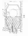 Fig. 13 - TRANSLUMINAL CARDIAC BALL VALVE AND METHOD FOR DEPLOYMENT THEREOF
