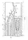 Fig. 15 - TRANSLUMINAL CARDIAC BALL VALVE AND METHOD FOR DEPLOYMENT THEREOF
