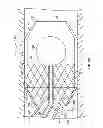Fig. 16 - TRANSLUMINAL CARDIAC BALL VALVE AND METHOD FOR DEPLOYMENT THEREOF