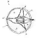 Fig. 01 - DEVICE FOR MITIGATING OR PREVENTING PARAVALVULAR LEAKS