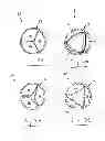 Fig. 03 - DEVICE FOR MITIGATING OR PREVENTING PARAVALVULAR LEAKS