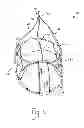 Fig. 05 - DEVICE FOR MITIGATING OR PREVENTING PARAVALVULAR LEAKS