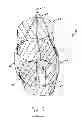 Fig. 06 - DEVICE FOR MITIGATING OR PREVENTING PARAVALVULAR LEAKS